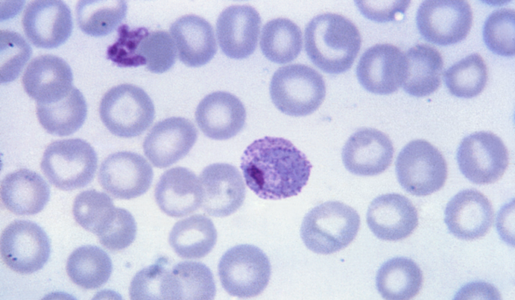 El genoma de Plasmodium vivax aporta nuevas vías y retos en la lucha global contra la malaria