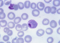 El genoma de Plasmodium vivax aporta nuevas vías y retos en la lucha global contra la malaria