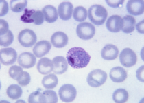 Plasmodium_vivax