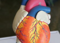 Niveles elevados de calcio en las coronarias predicen eventos cardíacos graves Niveles elevados de calcio en las coronarias predicen eventos cardíacos graves